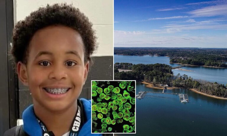 South Carolina Boy, 12, Dies From Brain-Eating Amoeba After Swimming in Lake Murray