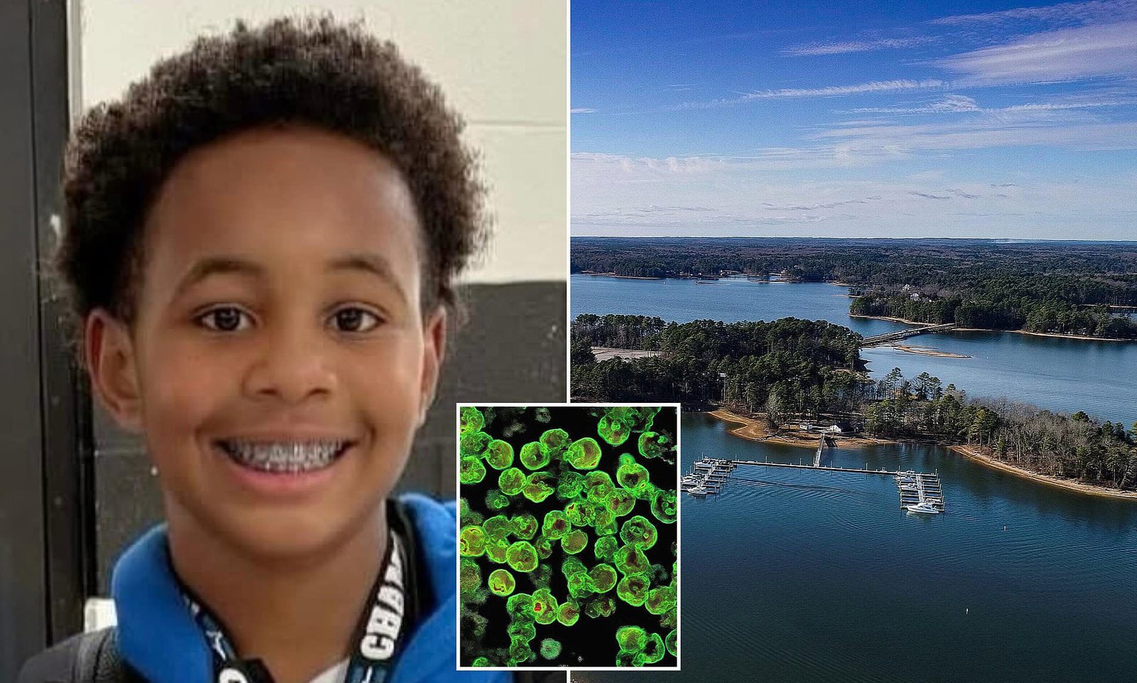 South Carolina Boy, 12, Dies From Brain-Eating Amoeba After Swimming in Lake Murray