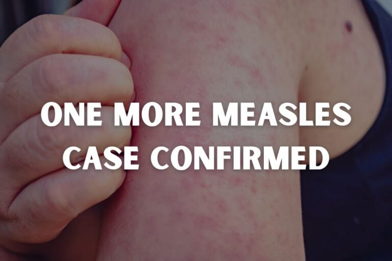 South Carolina Confirms Third Measles Case Since July