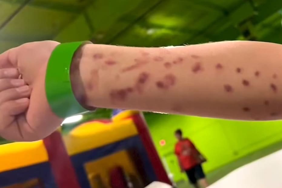 Texas Boy Injured After Giant Pacific Octopus Clings to His Arm at San Antonio Aquarium