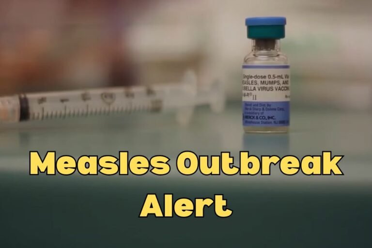 Measles Outbreak Alert