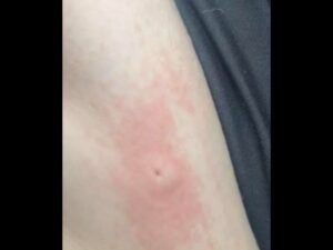 Deputies Clarify Viral Social Media Claim After Woman Alleges She Was Stabbed in Inman, South Carolina