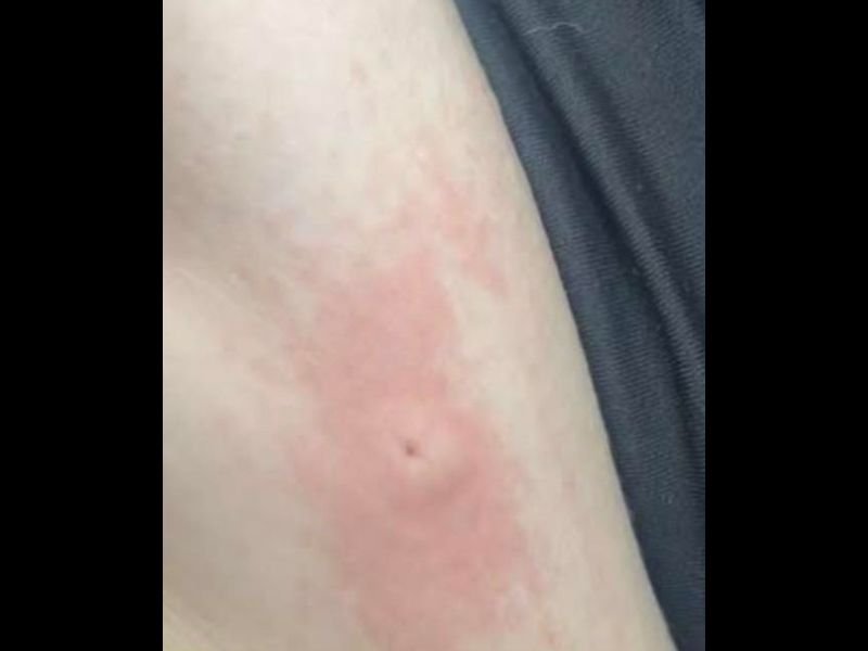 Deputies Clarify Viral Social Media Claim After Woman Alleges She Was Stabbed in Inman, South Carolina