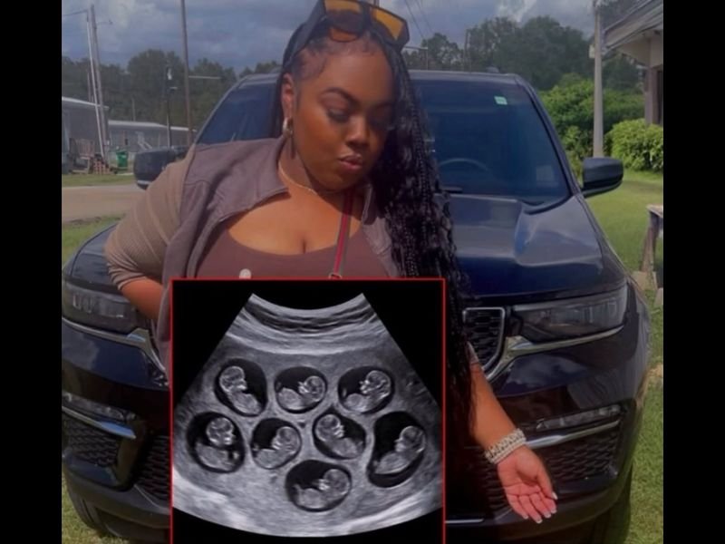 Florida Woman Goes Viral After Revealing She’s Pregnant With Octuplets
