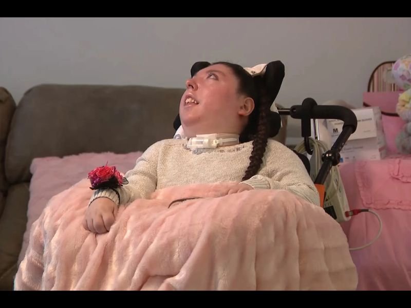 Nebraska Woman Born Without a Brain Defies Medical Odds, Celebrates 20th Birthday as Family Calls Her a ‘Miracle Fighter’
