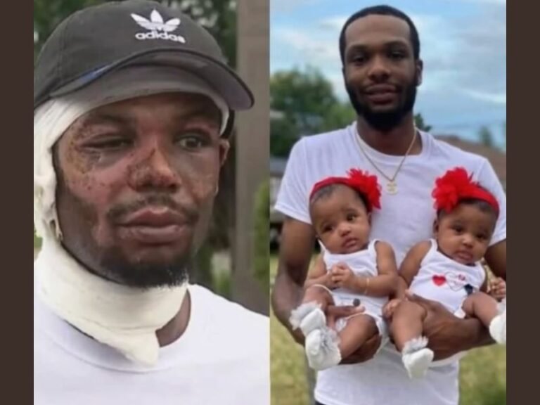 Michigan Father Suffers Severe Burns After Rushing Into Burning Home to Save His 18-Month-Old Twin Daughters